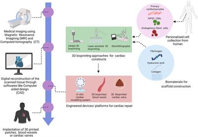 3D Bioprinting Technology – One Step Closer Towards Cardiac Tissue Regeneration